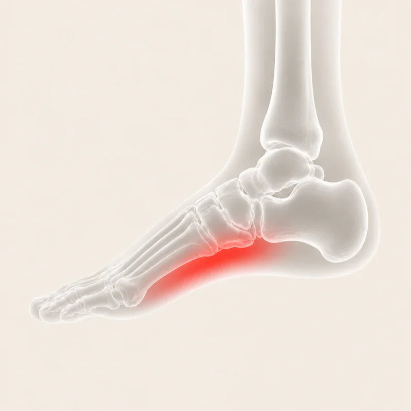 Arch Support & Recovery Set