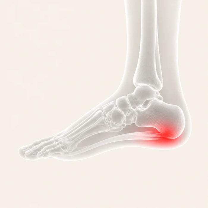 Most people don't need 
<em>surgery</em> as their first step.